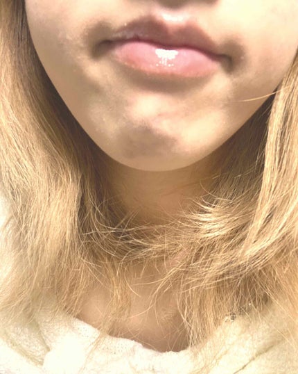 【旧】ディオール アディクト リップ マキシマイザー/Dior/リップグロスを使ったクチコミ(2枚目)