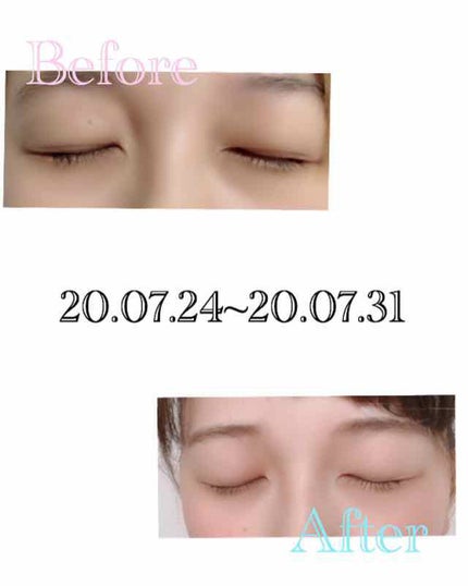 スカルプD ボーテ ピュアフリーアイラッシュセラム/アンファー(スカルプD)/まつげ美容液を使ったクチコミ(2枚目)