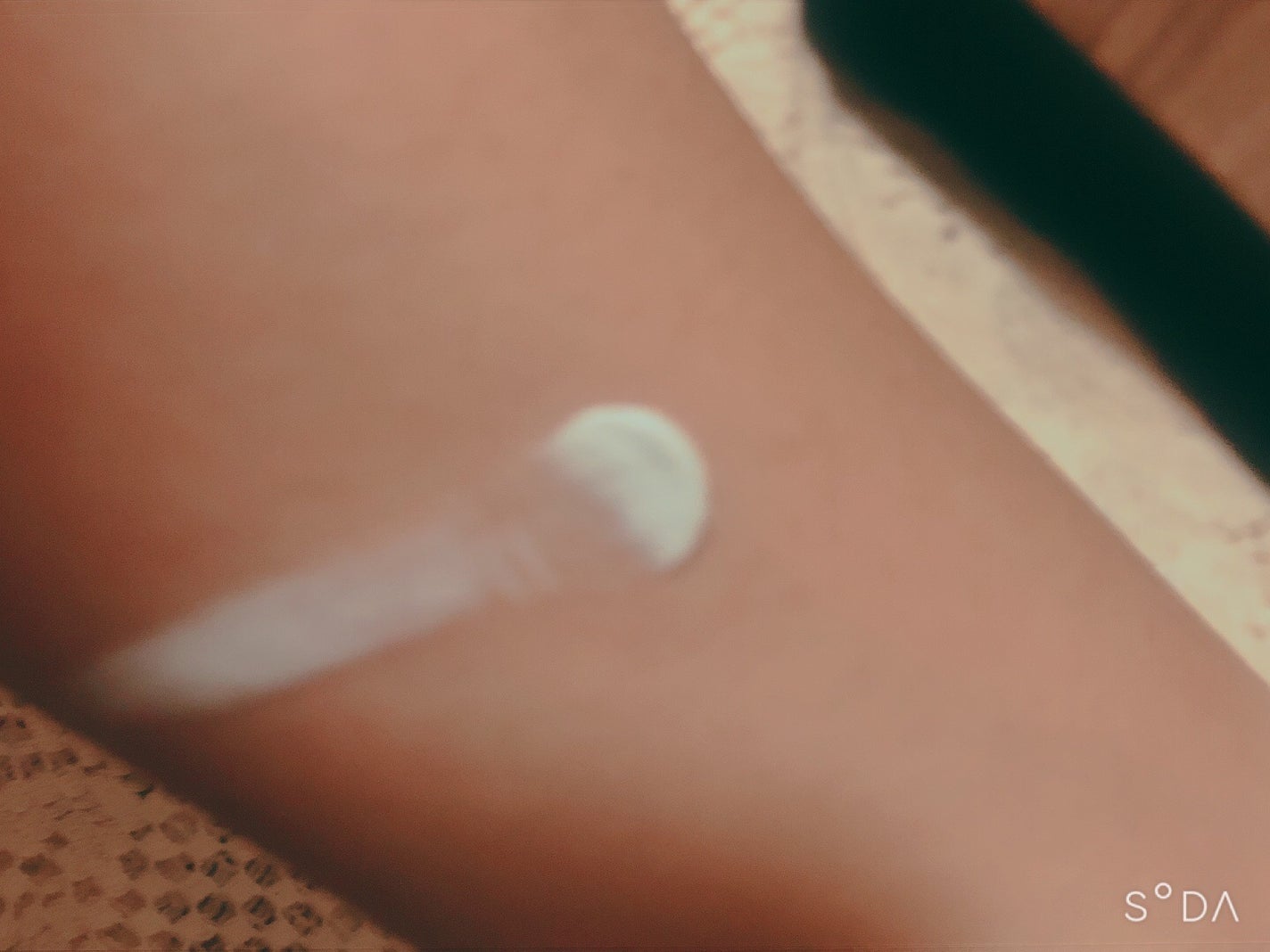 シカルファットプラス リペアクリーム/アベンヌ/フェイスクリームを使ったクチコミ(3枚目)