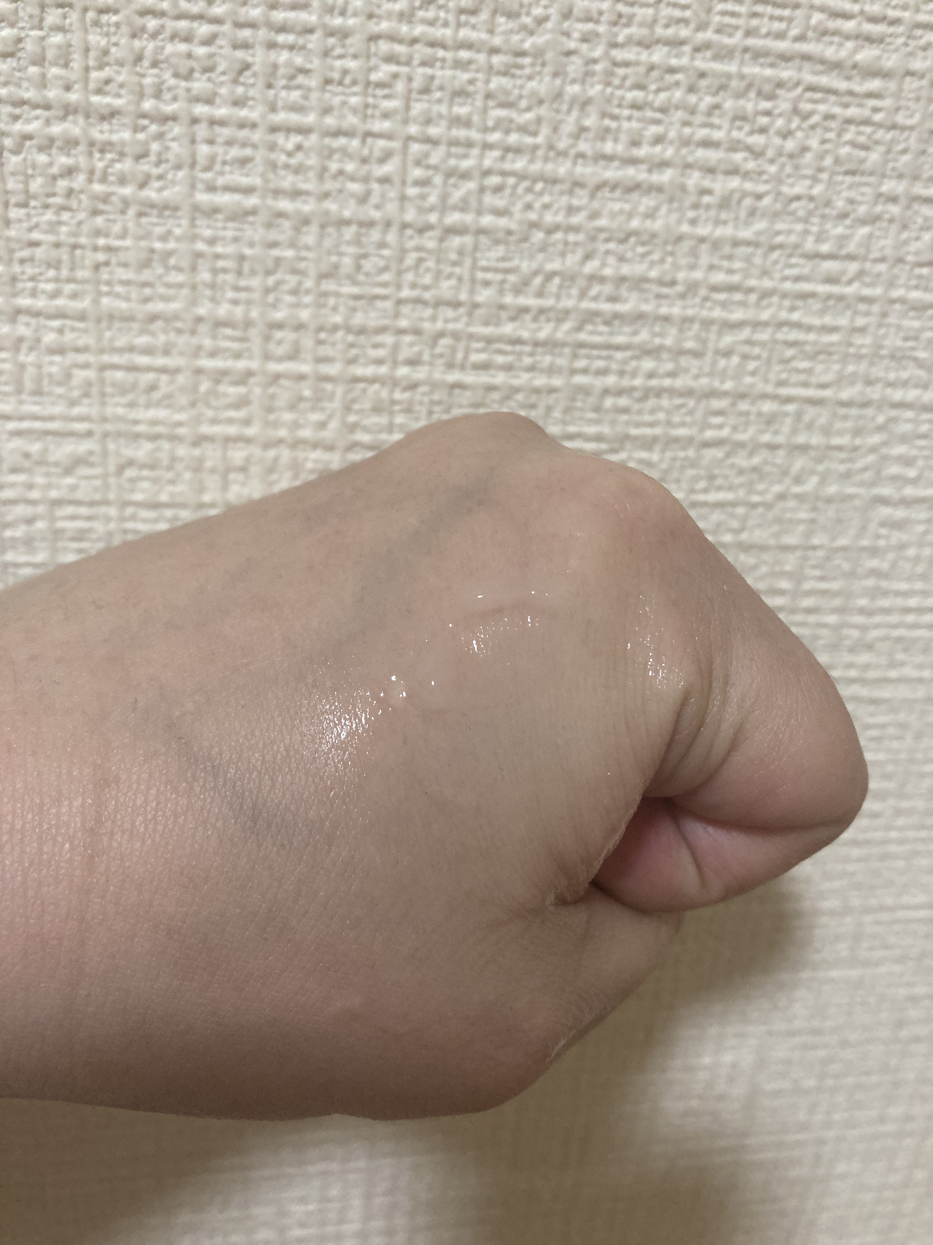 ダーマレーザー R100ジェルクリーム/クオリティファースト/フェイスクリームを使ったクチコミ（3枚目）