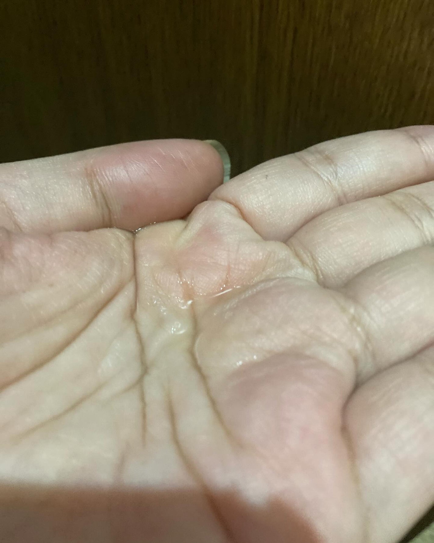 薬用スカルプセラム/wicot/頭皮ローションを使ったクチコミ(5枚目)