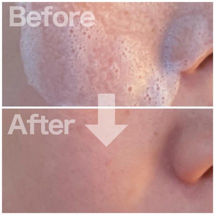 St-Care クレンジングオイルフォーム/orin/洗顔フォームを使ったクチコミ(6枚目)