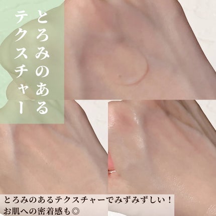 ノスカナイン トラブル セラム/FATION/美容液を使ったクチコミ(5枚目)