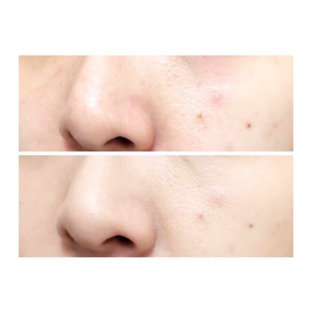 ダブルラスティング セラムファンデーション/ETUDE/リキッドファンデーションを使ったクチコミ(4枚目)