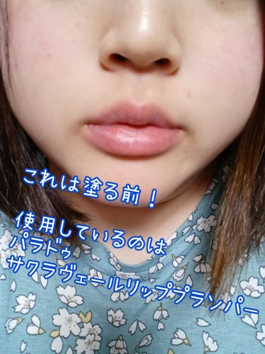 空良 on LIPS 「唇が痺れる強プランパー！！ビリビリかんがまたくせになりそう👄👄..」（3枚目）