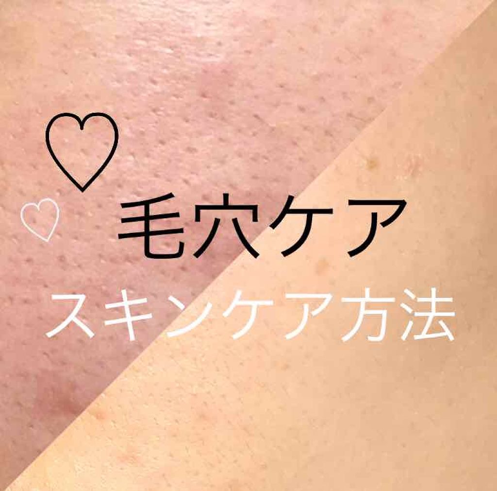 ハトムギ化粧水(ナチュリエ スキンコンディショナー R )/ナチュリエ/化粧水を使ったクチコミ(1枚目)