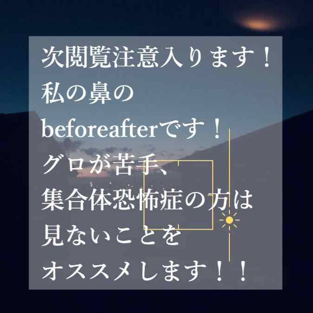 さかなのらく 美顔器 /BLAU HANDEL/美顔器・マッサージを使ったクチコミ（2枚目）