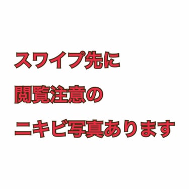 コリコリ🇰🇷💓 on LIPS 「(閲覧注意)ニキビ写真あり小学6年生からニキビ女です。戦って約..」（2枚目）