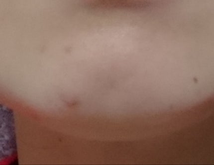 インビジブルピーリングブースターエッセンス/CNP Laboratory/ブースター・導入液を使ったクチコミ(3枚目)