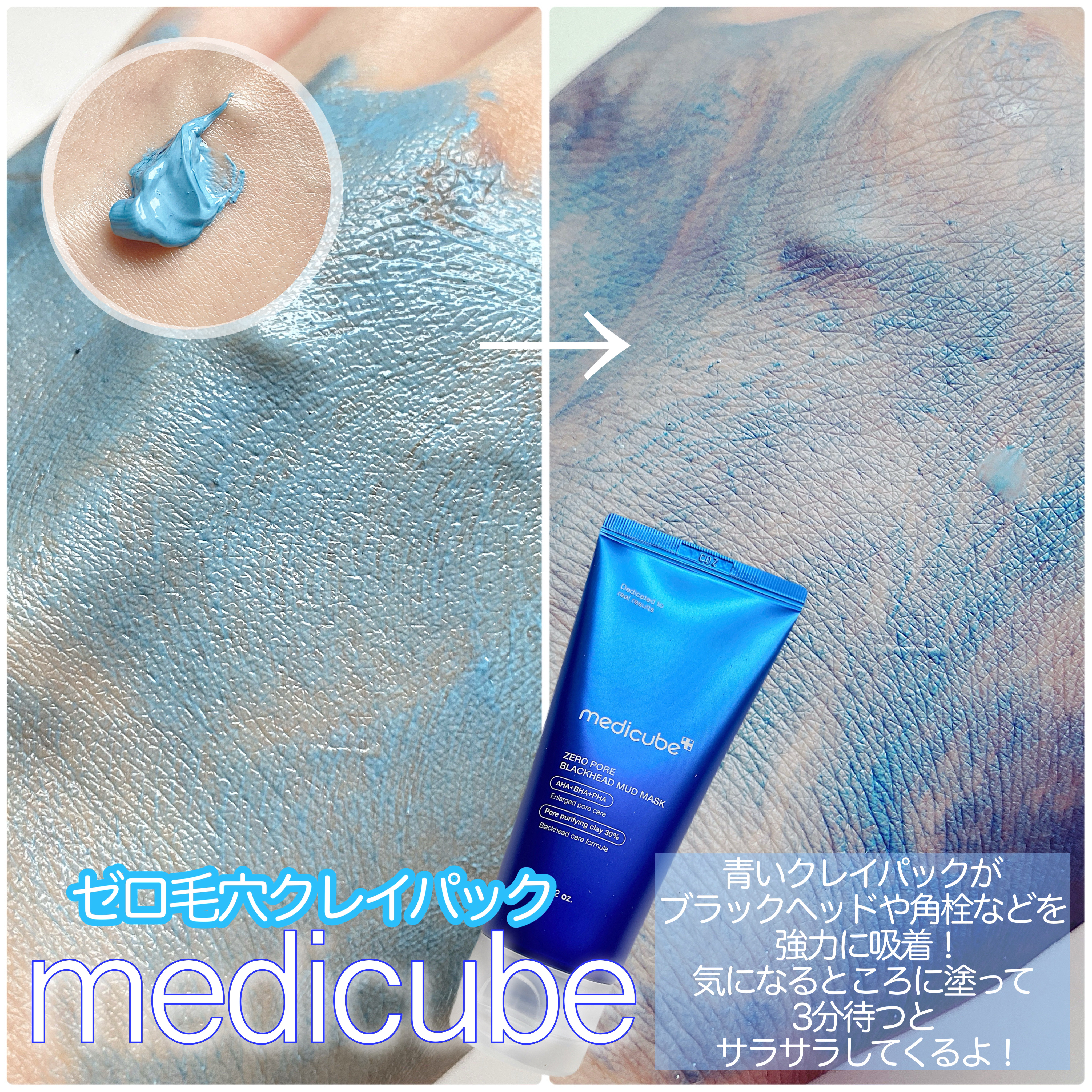 ゼロ毛穴パッド 2.0/MEDICUBE/トナーパッドを使ったクチコミ（2枚目）