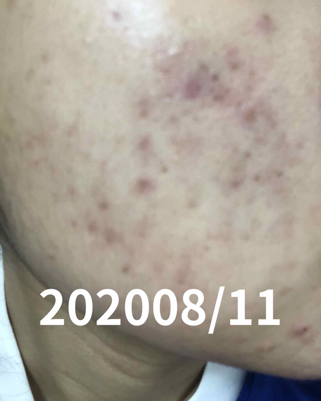 白色ワセリン(医薬品)/健栄製薬/その他を使ったクチコミ（2枚目）