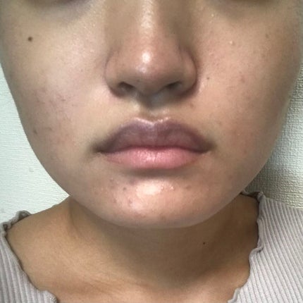 マスクフィットオールカバーデュアルコンシーラー/TIRTIR(ティルティル)/コンシーラーを使ったクチコミ(2枚目)