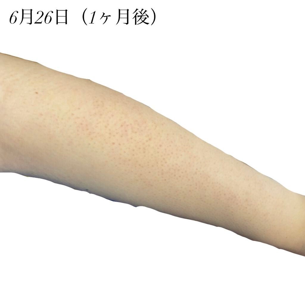 ハトムギ化粧水(ナチュリエ スキンコンディショナー R )/ナチュリエ/化粧水を使ったクチコミ(4枚目)