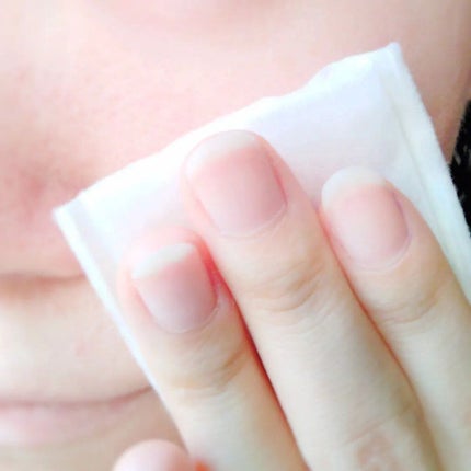 シーバムコントロールVCローションII/プリモディーネ/化粧水を使ったクチコミ(5枚目)