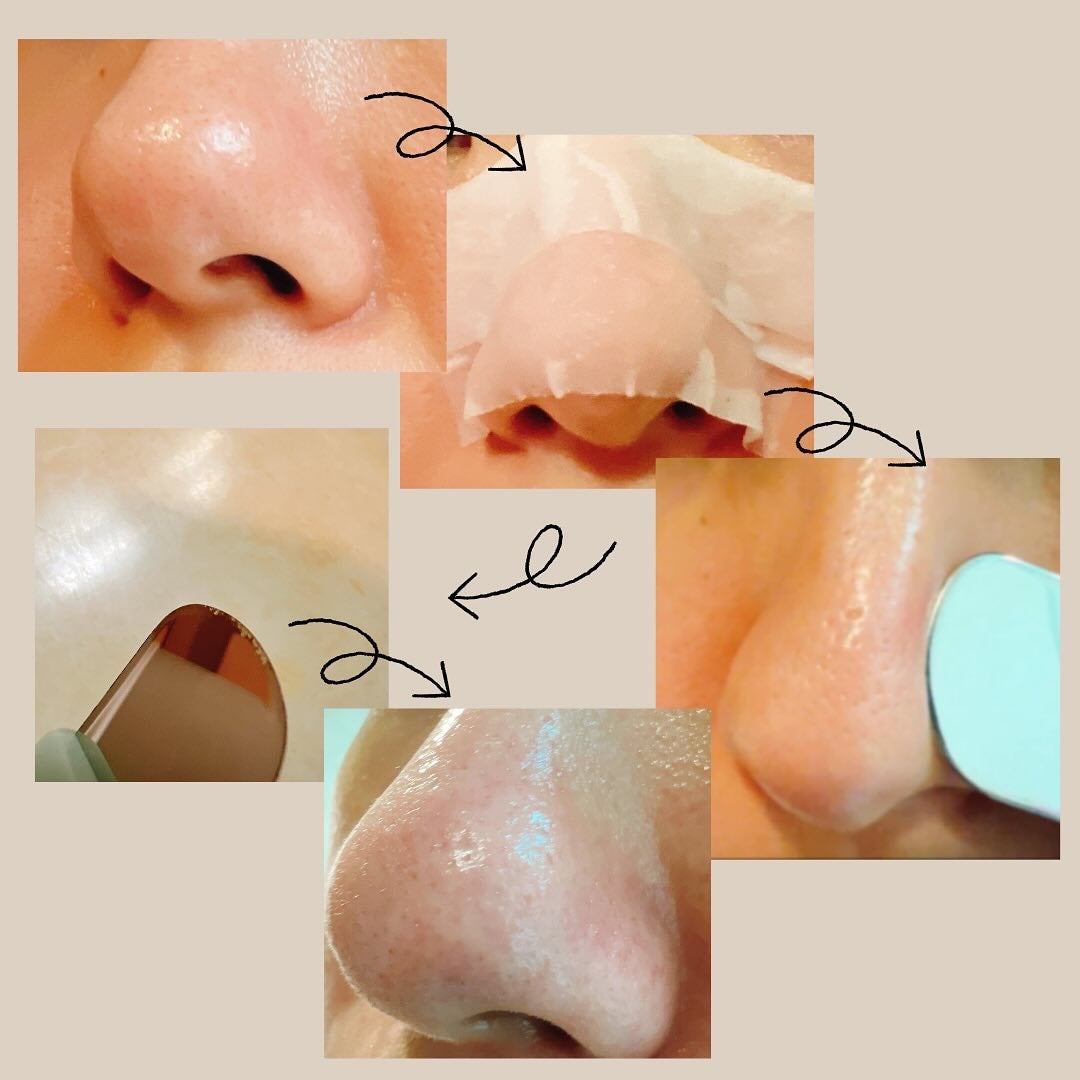 ナチュラルマイルドクリアノーズパック/ilso/シートマスク・パックを使ったクチコミ(3枚目)