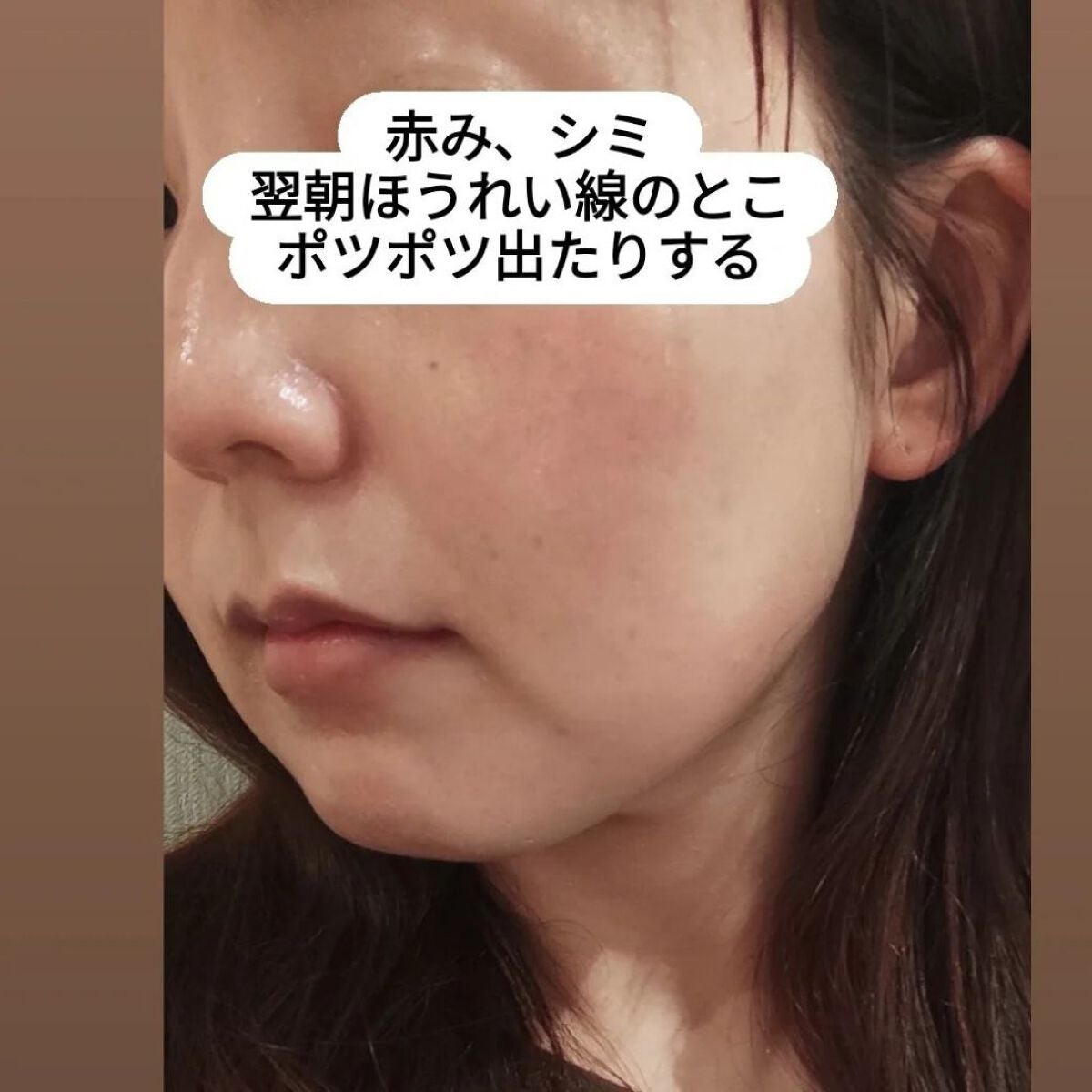 ミシャ ビタシープラス デイリーマスク【日本処方】/MISSHA/シートマスク・パックを使ったクチコミ(7枚目)