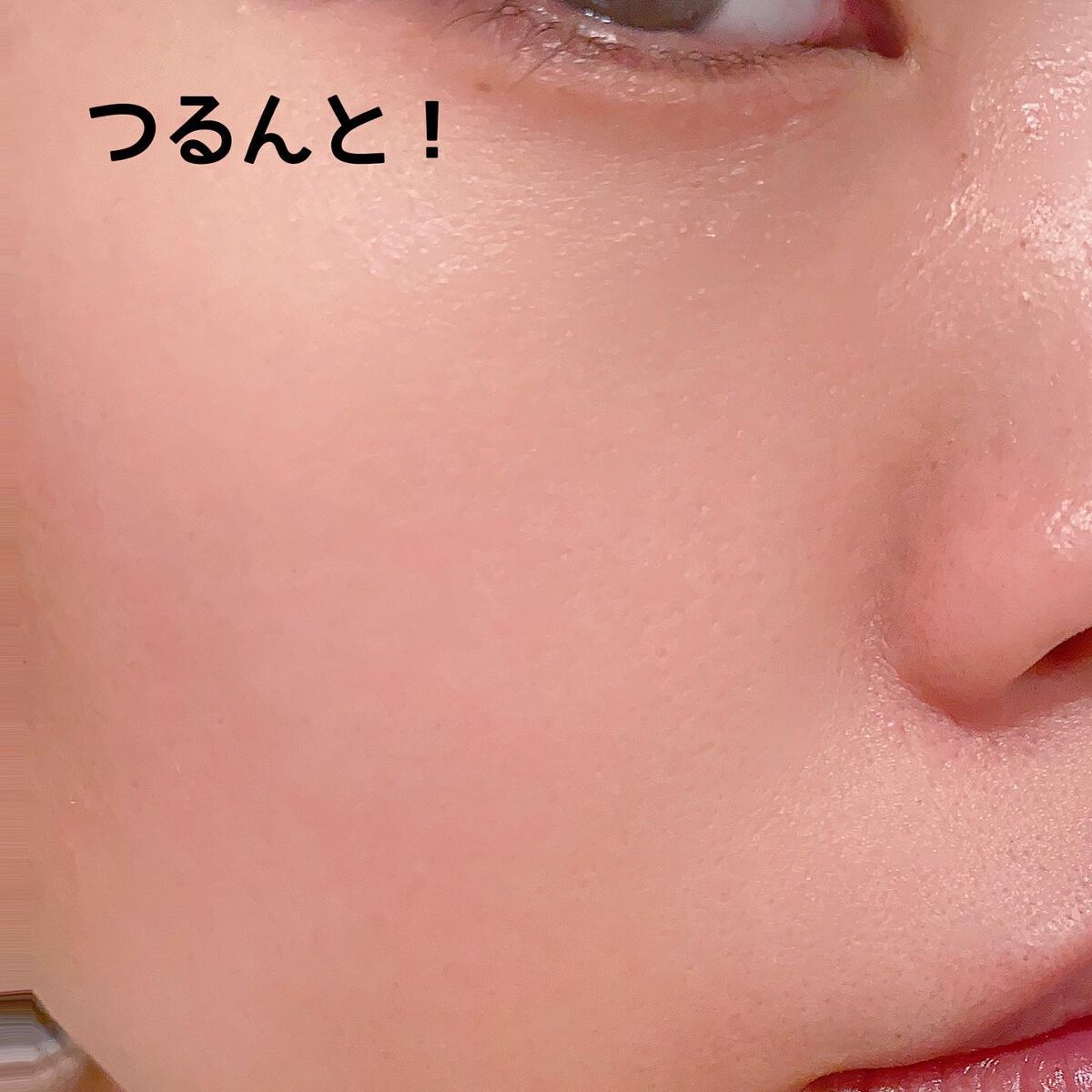 ニードル炭酸パック/NNE/洗い流すパック・マスクを使ったクチコミ(5枚目)