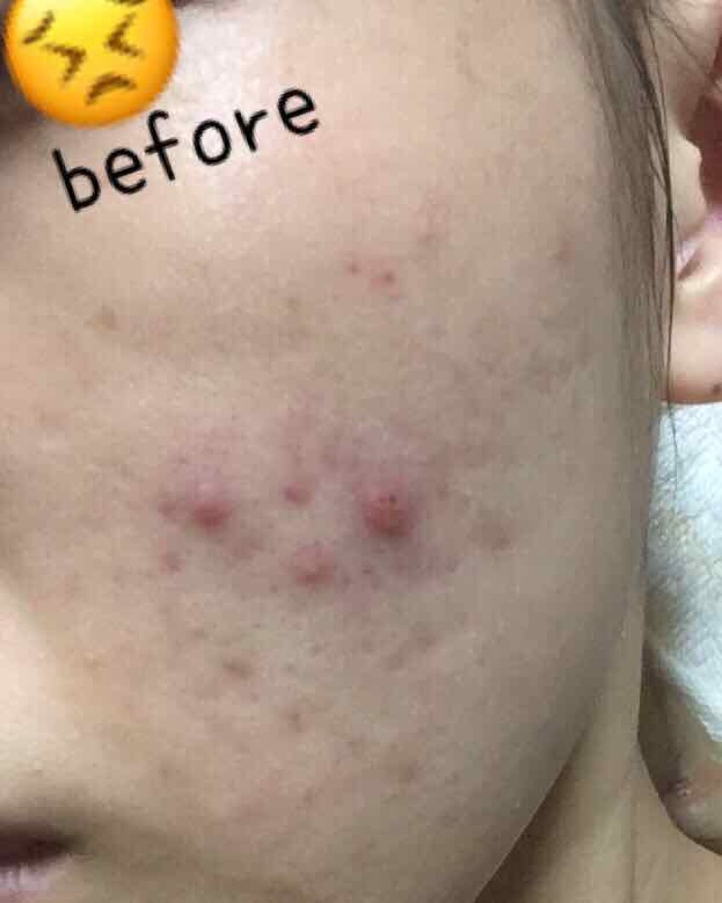 薬用 クリアローション M(しっとりタイプ)/オルビス/化粧水を使ったクチコミ（2枚目）