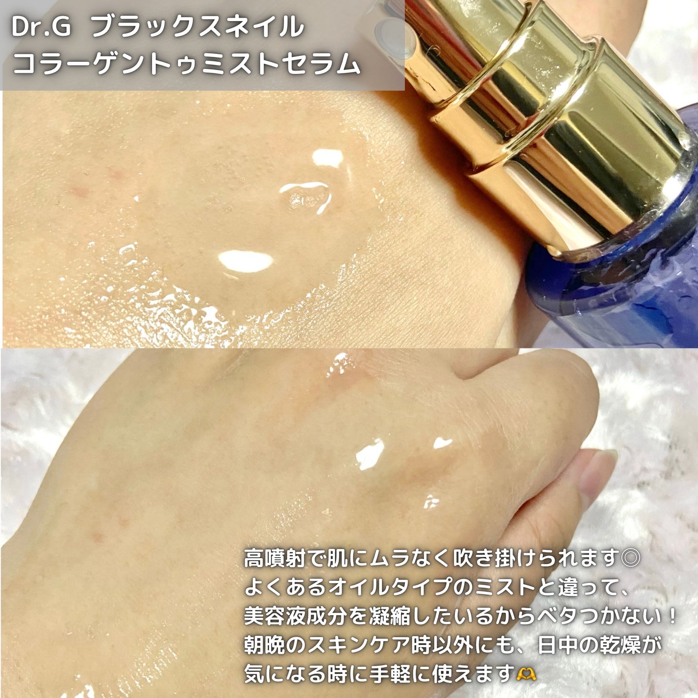 ドクタージー ブラックスネイル コラーゲンミスト/Dr.G/ミスト状化粧水を使ったクチコミ(2枚目)