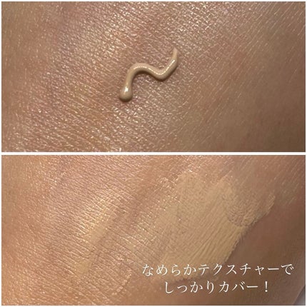 薬用スポットシーラークリーム/スキンヒーロー/クリームコンシーラーを使ったクチコミ(4枚目)