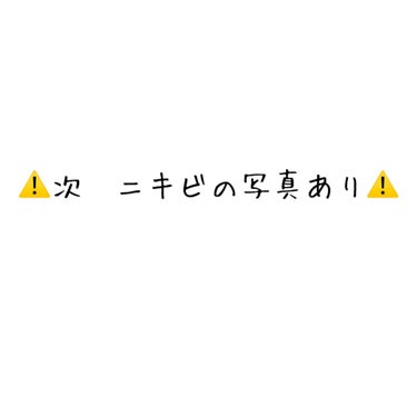 ホワイトニングクリア セット/d プログラム/スキンケアキットを使ったクチコミ（2枚目）