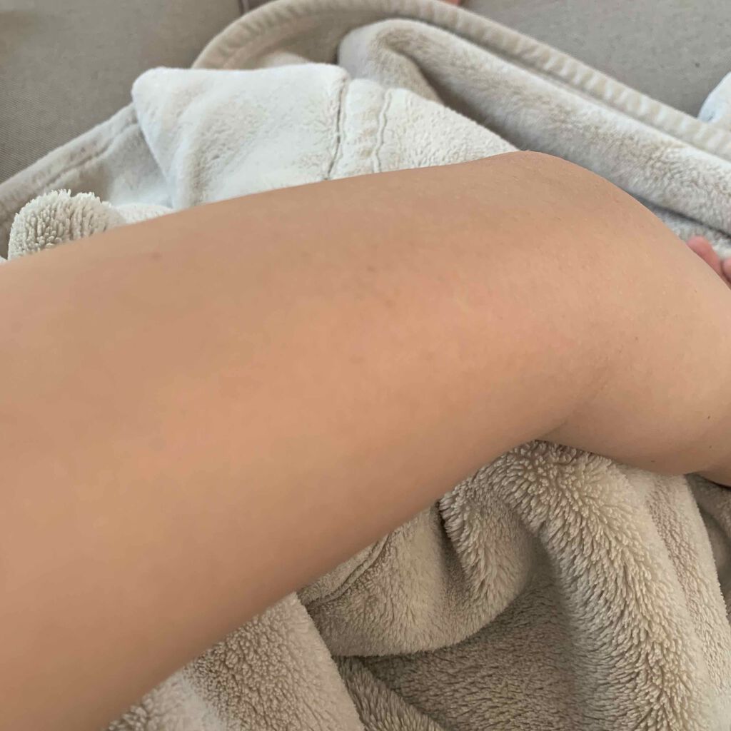 ニキビを防ぐ薬用石鹸 ForBack/ペリカン石鹸/ボディ石鹸を使ったクチコミ（2枚目）