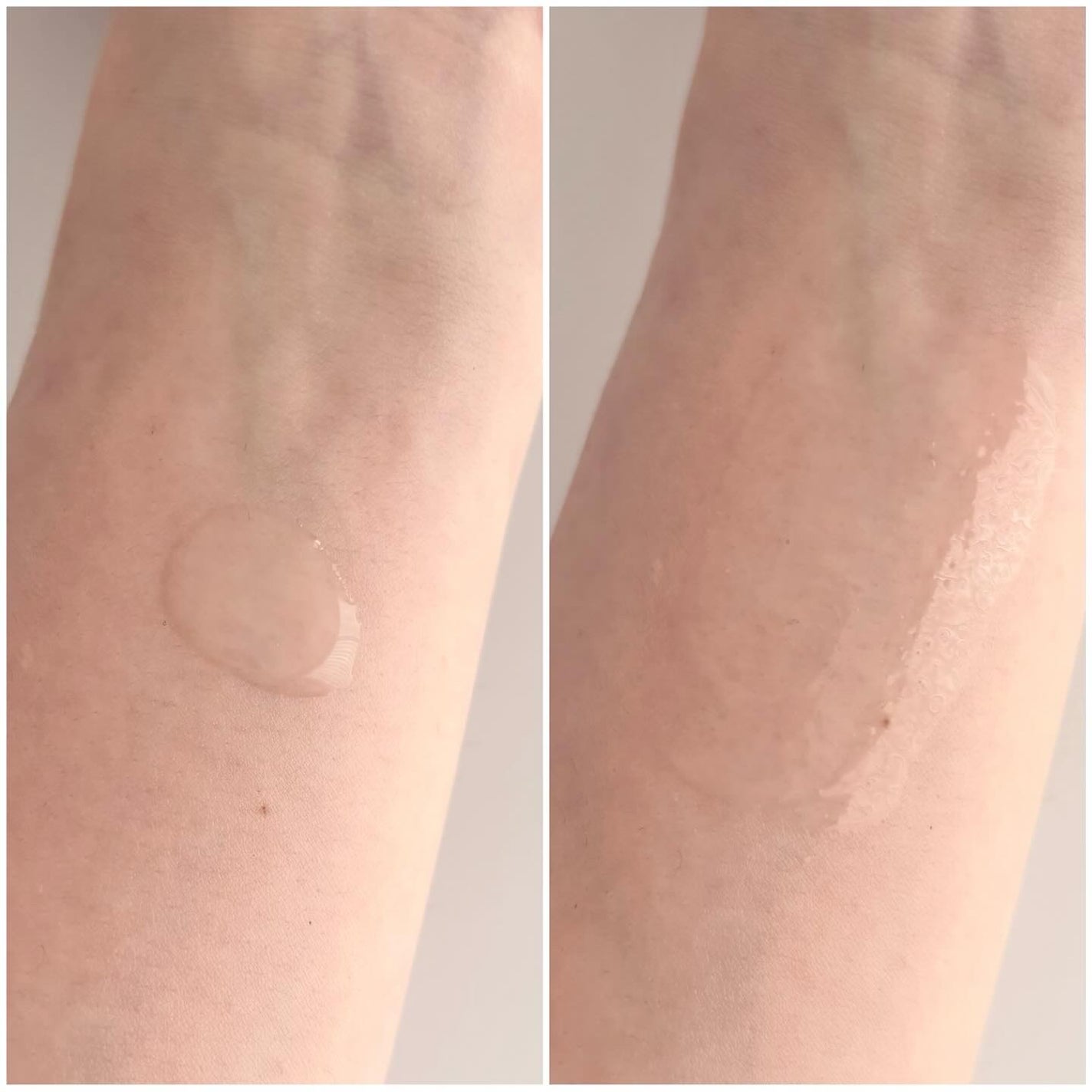 TX-Cream/Dr.Melaxin/フェイスクリームを使ったクチコミ(4枚目)