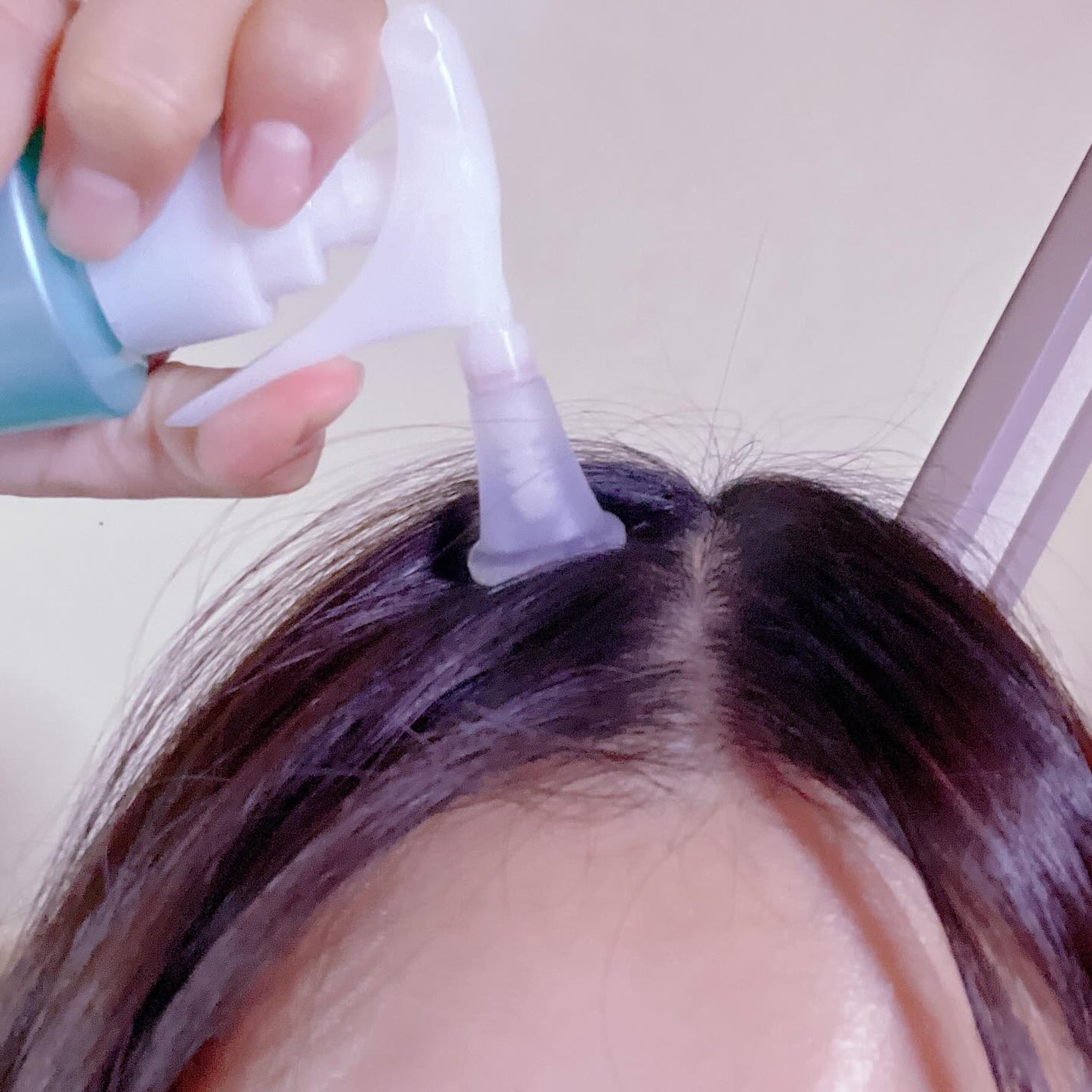 スペシャルケアセット(スキャルプパッチ/育毛トニック)/fasa/頭皮ローションを使ったクチコミ(3枚目)