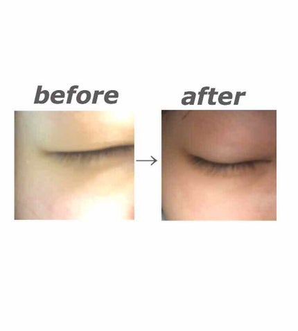 ローヤルゼリー配合 栄養ローション/DAISO/美容液を使ったクチコミ(1枚目)