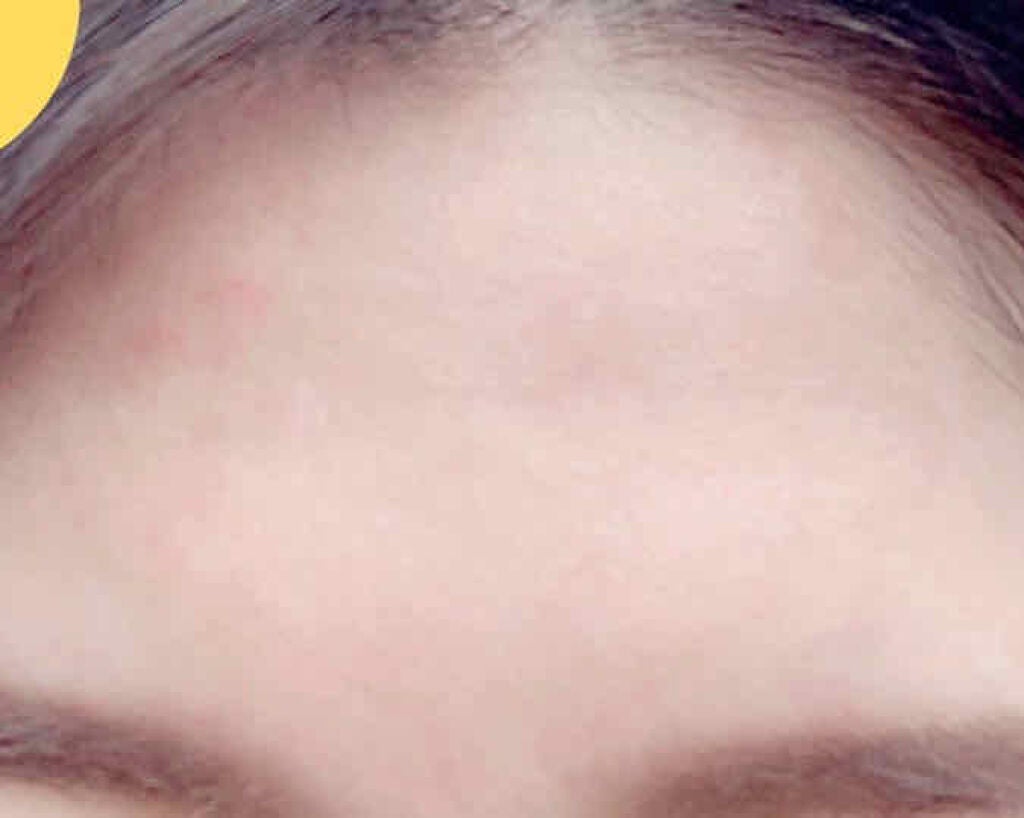 潤浸保湿 化粧水 III とてもしっとり/キュレル/化粧水を使ったクチコミ(3枚目)