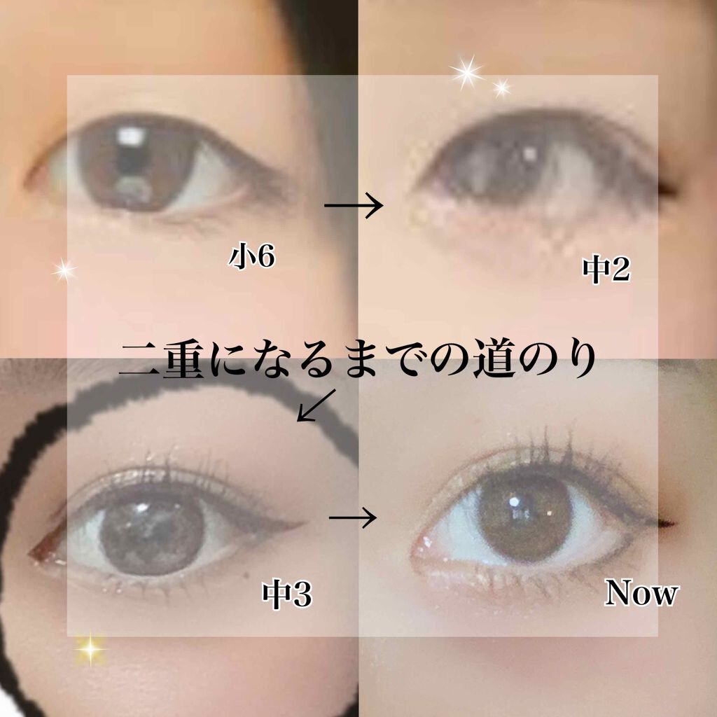 ワンダーアイリッドテープ Extra/D-UP/二重まぶた用アイテムを使ったクチコミ(1枚目)