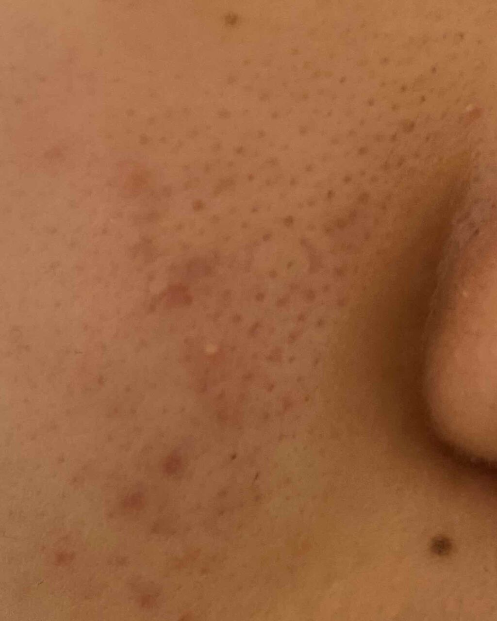 ã²ããð¥ on LIPS ãå©ããŠãã ããâŠèªç²äžããã¡ã³ããŒã·ã§ã³ãªã©ããªãããå°ãã¯è..ãïŒ2æç®ïŒ