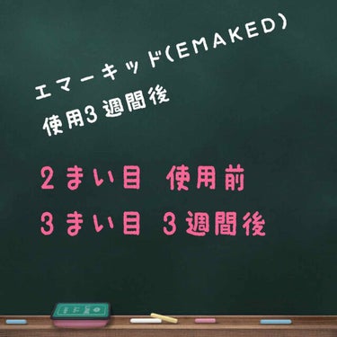 3週間使用した結果です！

まず、横から見ると
すごく伸びました！

なんか写真では上手く伝わらない…

したまつ毛は薄いままだけど長さは
長くなってきてます！

うえまつ毛は濃くなったし
長くなったし