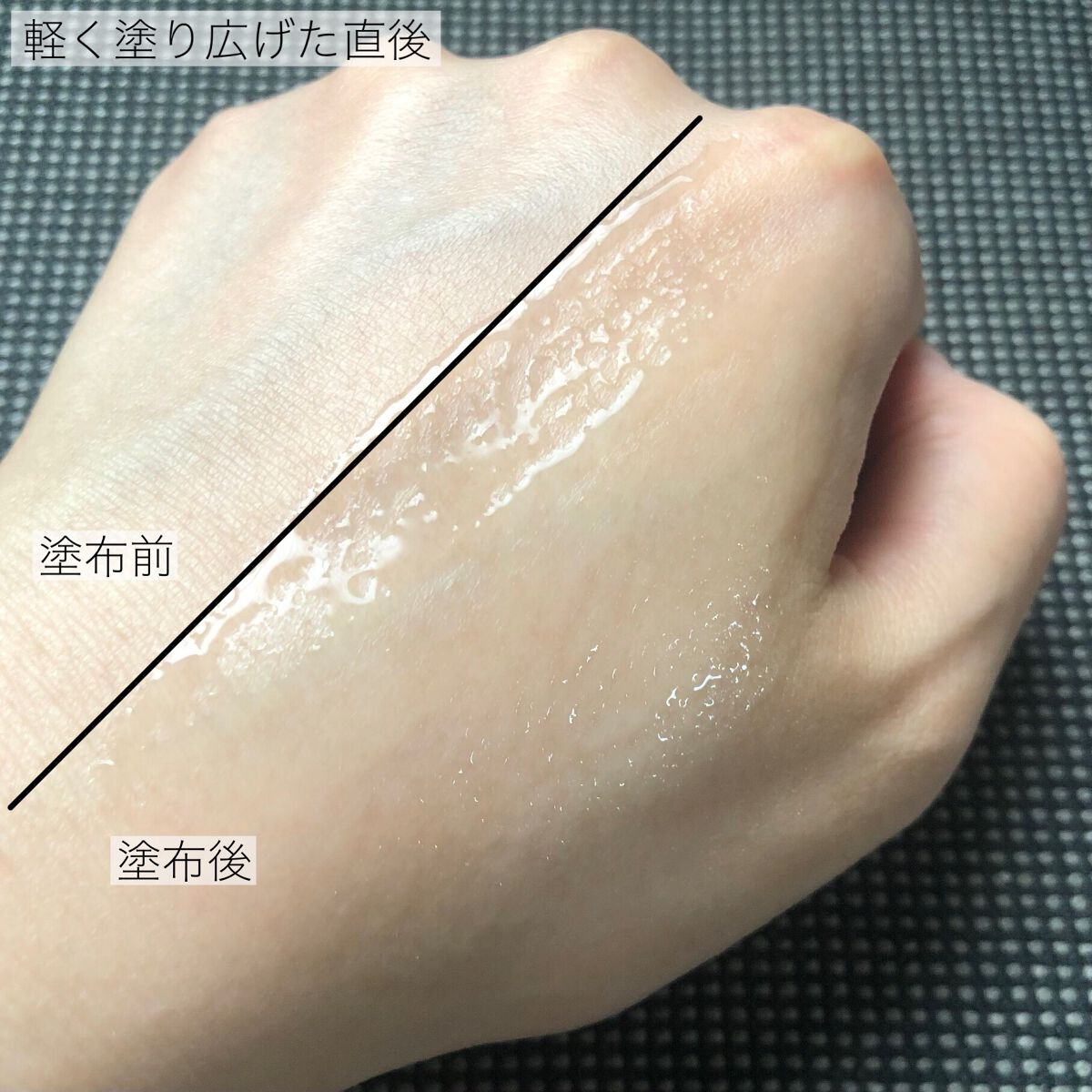 エファクラ ピールケア セラム/ラ ロッシュ ポゼ/美容液を使ったクチコミ(3枚目)