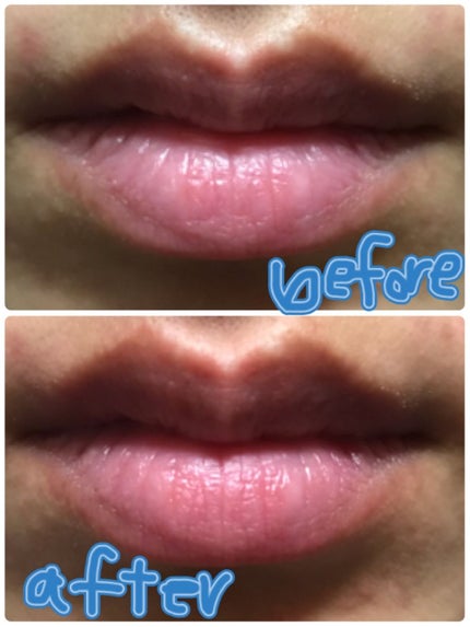 ミツバチ リップスクラブ/ラッシュ/リップスクラブを使ったクチコミ(3枚目)