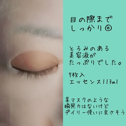 ルルルンOVER45 カメリアピンク(モイスト)/ルルルン/シートマスク・パックを使ったクチコミ(2枚目)