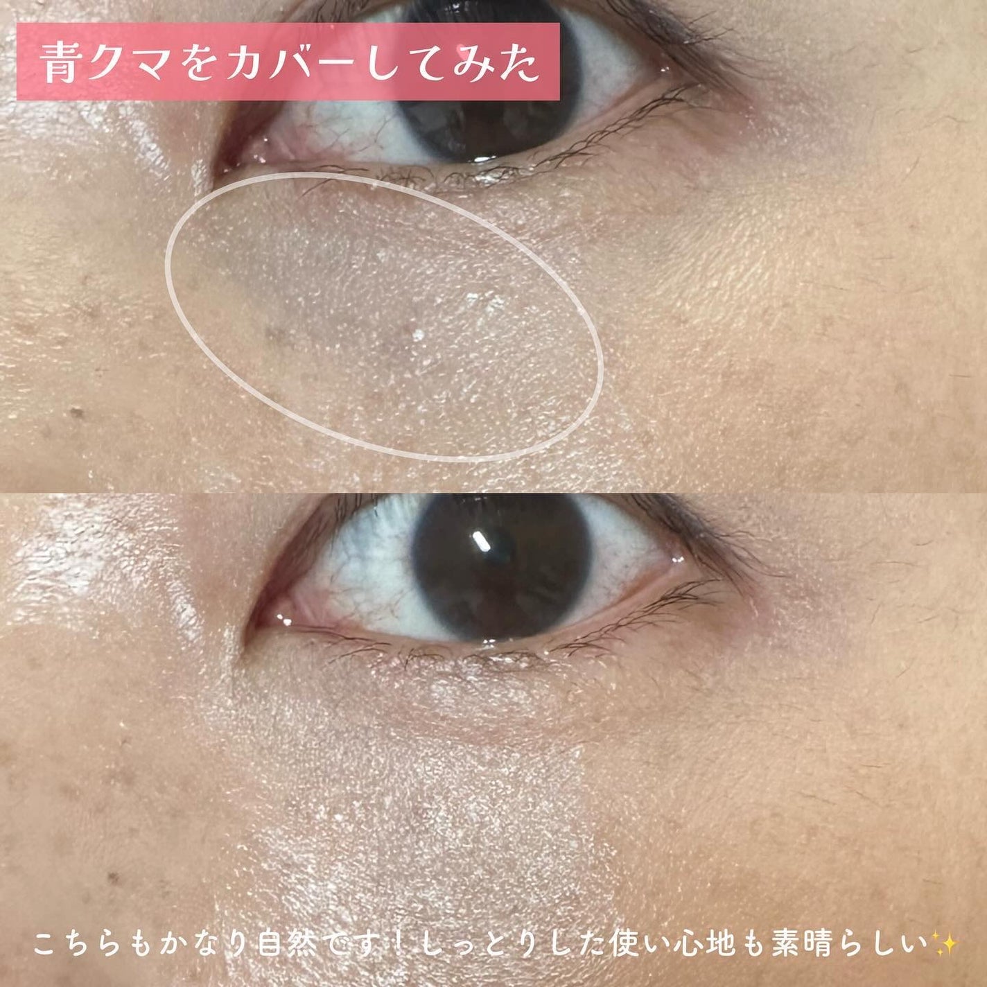 コンシールブレンダーパレット/LUNA/パレットコンシーラーを使ったクチコミ(8枚目)