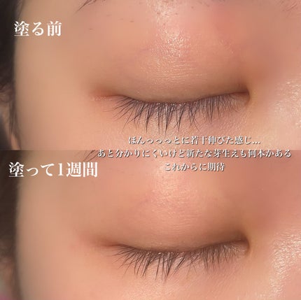 FEG Eyelash Enhancer/FEG/まつげ美容液を使ったクチコミ(4枚目)