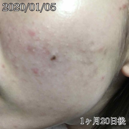 AC モイスチュアジェル/NOV/美容液を使ったクチコミ(4枚目)