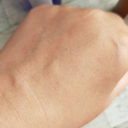 タカミスキンピール/タカミ/ブースター・導入液を使ったクチコミ(4枚目)