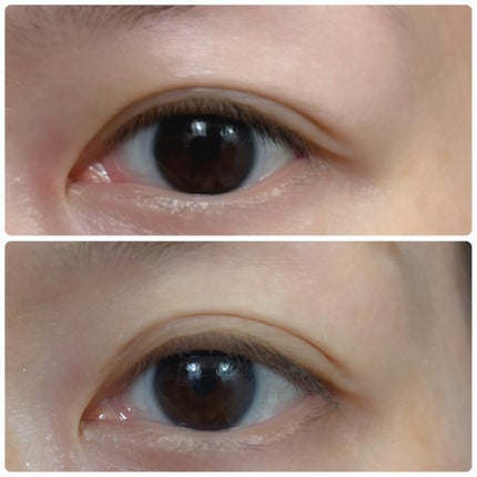 メザイク イージークリア 接着クリアタイプ/メザイク/二重まぶた用アイテムを使ったクチコミ(4枚目)