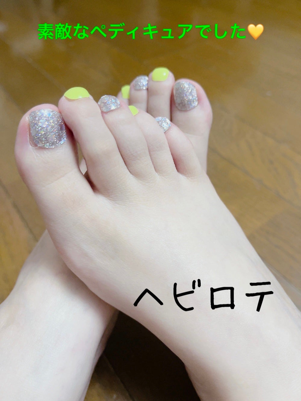 オホーラ ジェルランプ/ohora/ネイル用品を使ったクチコミ(2枚目)