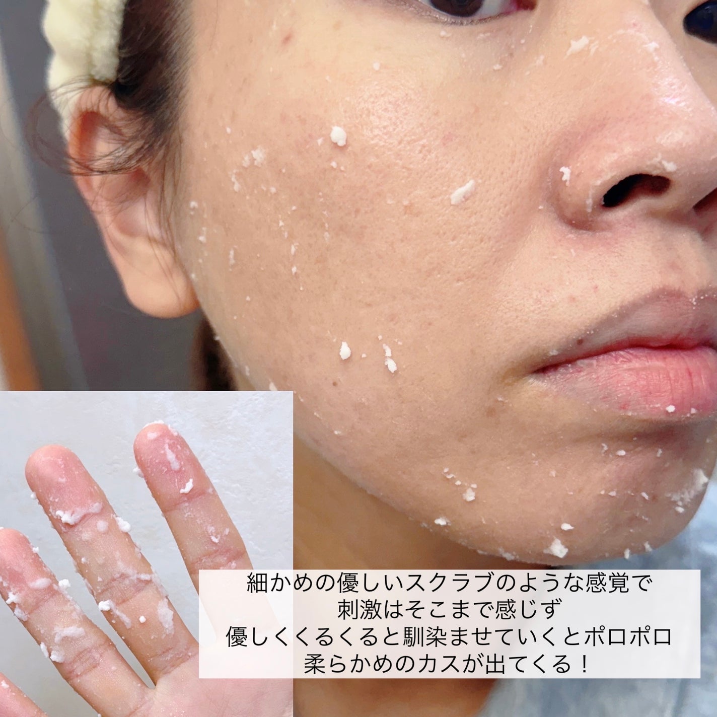 ENERGY REFRESH PEELING GEL/WONJIN EFFECT/ピーリングを使ったクチコミ(3枚目)