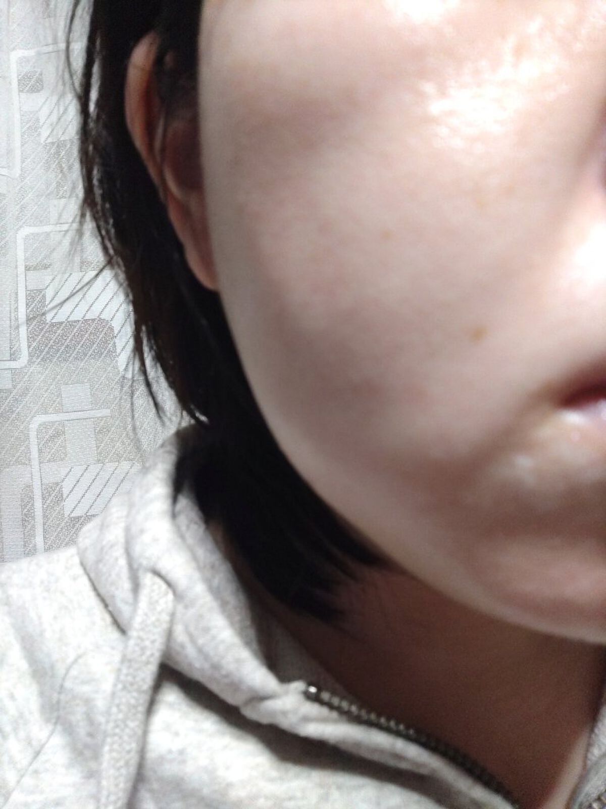 ダーマスキンピーリング/BQCELL/その他キットセットを使ったクチコミ（3枚目）