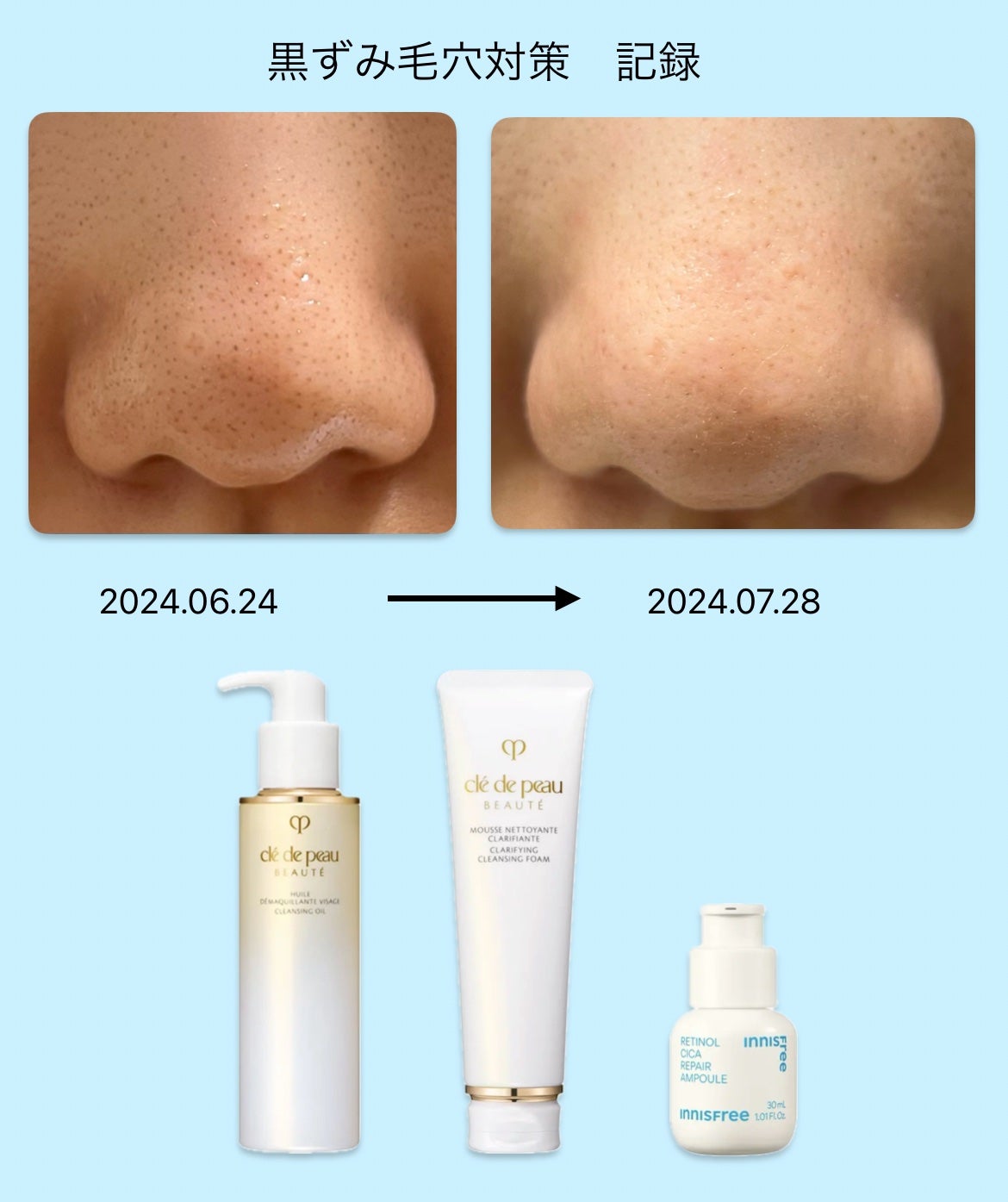 ムースネトワイアントCn/クレ・ド・ポー ボーテ/洗顔フォームを使ったクチコミ(1枚目)