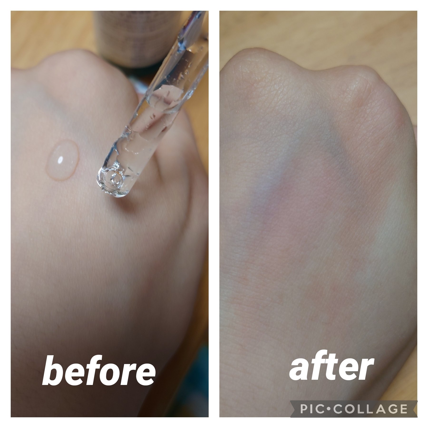 エファクラ ピールケア セラム/ラ ロッシュ ポゼ/美容液を使ったクチコミ（3枚目）