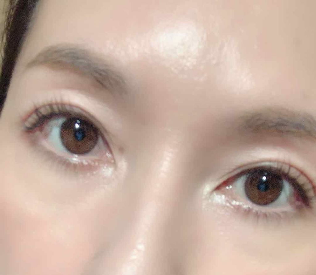 キュアレア（医薬品）/キュアレアa/その他を使ったクチコミ（2枚目）