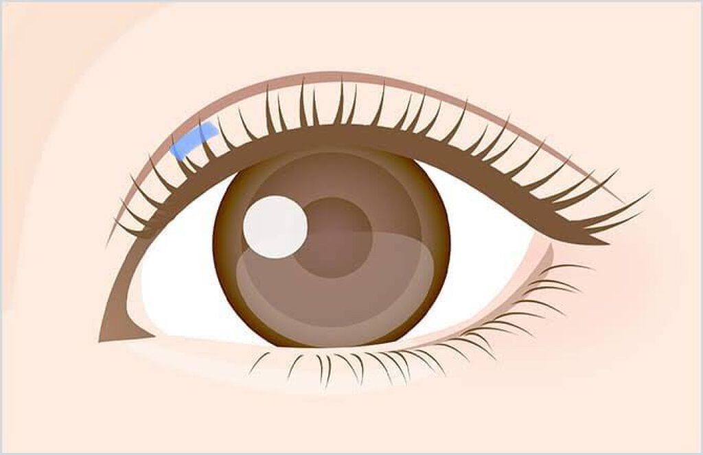 のびーるアイテープ(絆創膏タイプ、レギュラー)/DAISO/二重まぶた用アイテムを使ったクチコミ(7枚目)