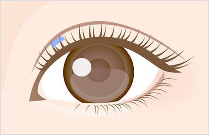 のびーるアイテープ(絆創膏タイプ、レギュラー)/DAISO/二重まぶた用アイテムを使ったクチコミ(7枚目)