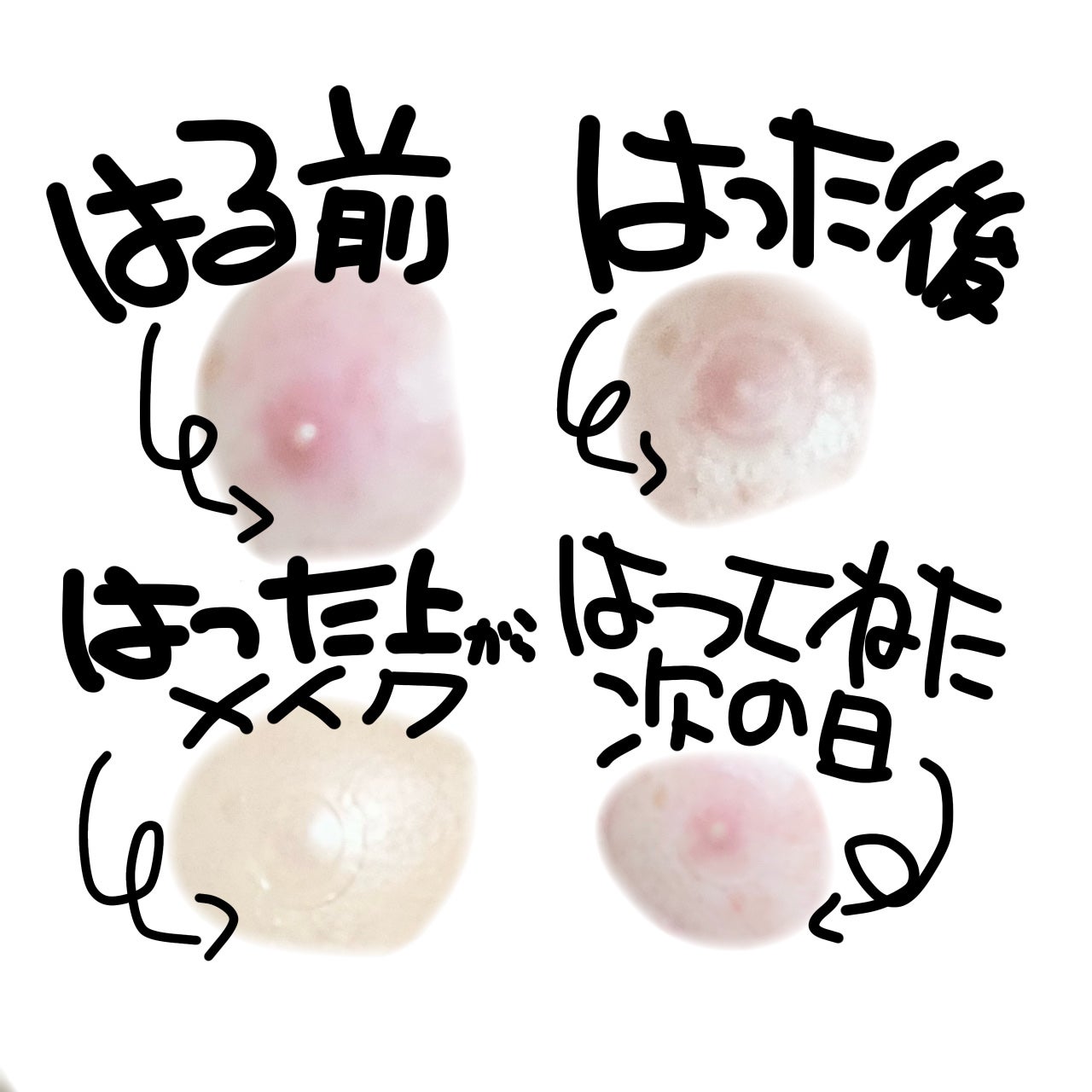 ゼロスポットパッチ VITA/Today’s Cosme/その他スキンケアを使ったクチコミ(3枚目)